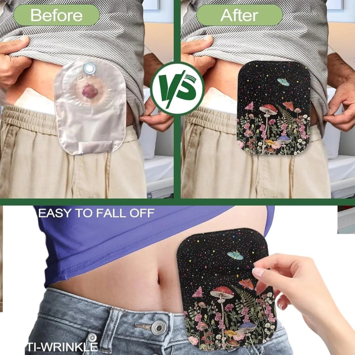 Rnyleeg 4 Pcs Ostomy Pouch Covers for Women Mushroom Butterfly Pattern Colostomy Supplies for Home Work Travel Portable Ostomy Bag Accessories